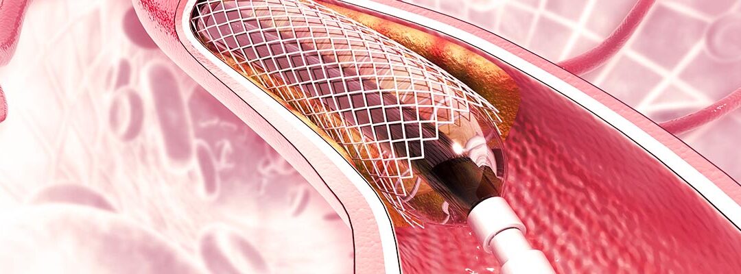 Dolor mandibular puede indicar riesgo cardiaco en mujeres