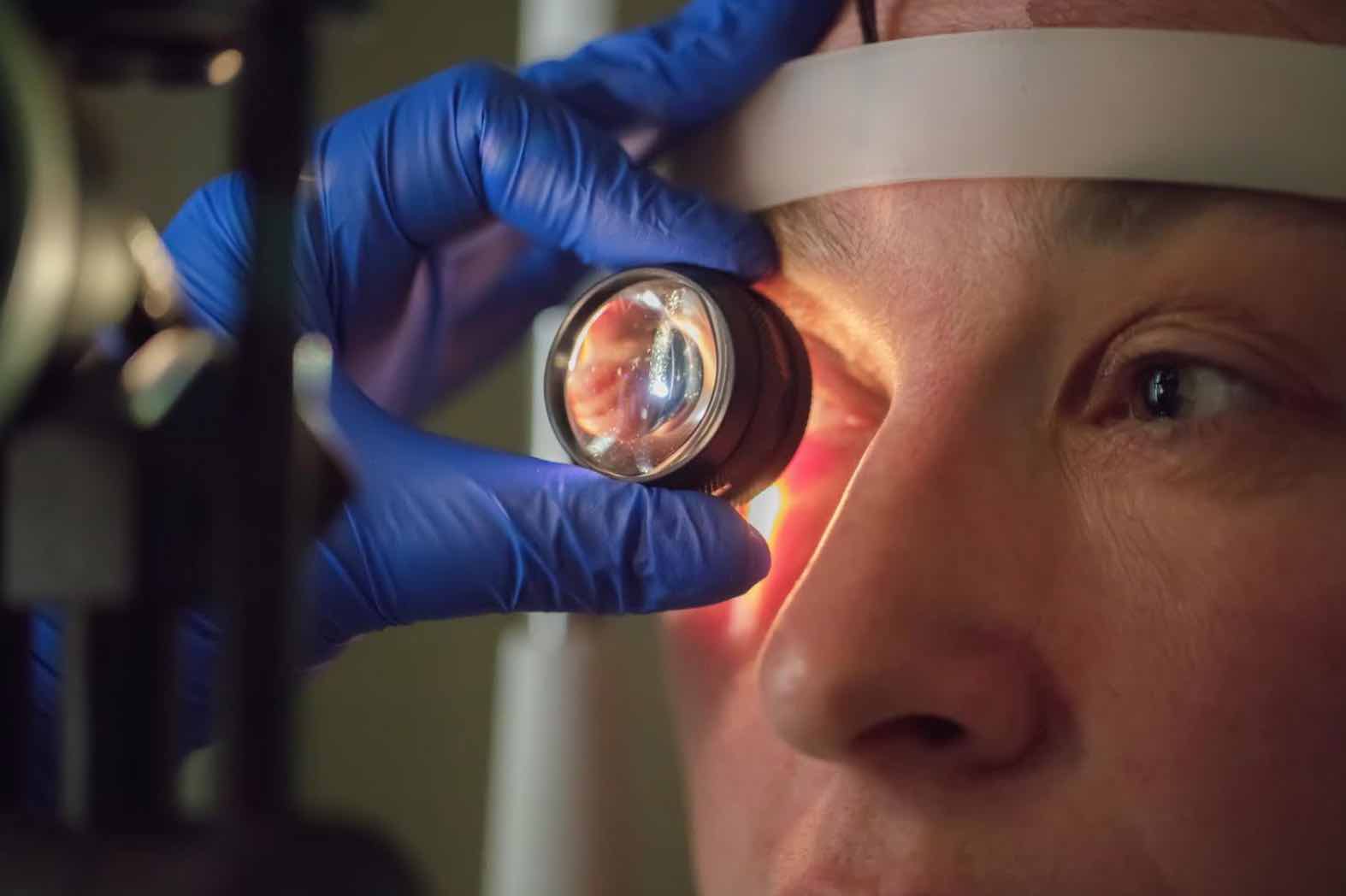 El queratocono afecta a jovenes sin causar dolor